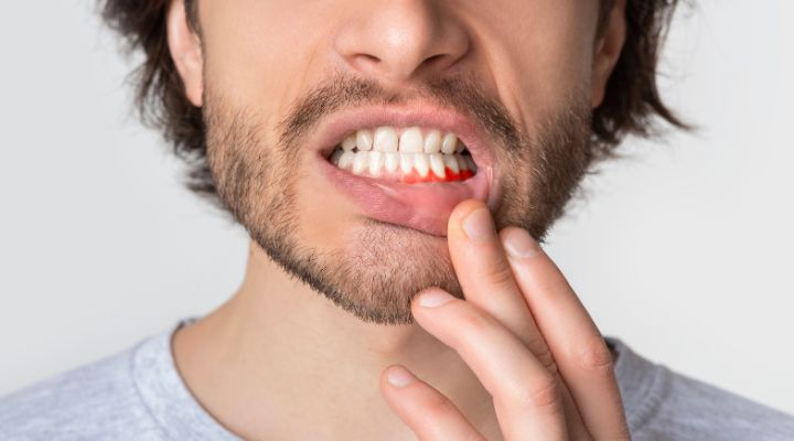 What Is The Strongest Natural Antibiotic For Tooth Infection?